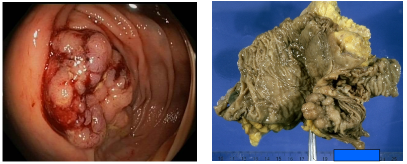 Pathologies digestives et imagerie - OED