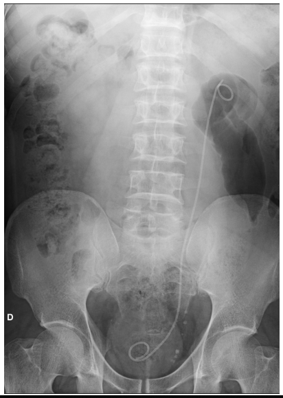 Pathologies néphro-urologiques et radiologie chez l'adulte