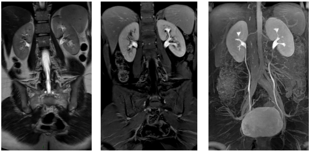 Voies urinaires, prostate, testicules